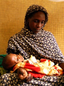 Ali, a 16-month-old baby who is being treated for severe acute malnutrition