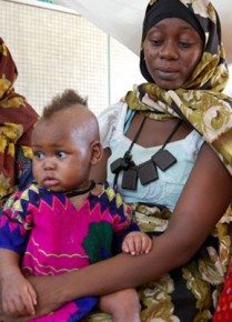 18-month-old Fatima with her mother, Marian Awat