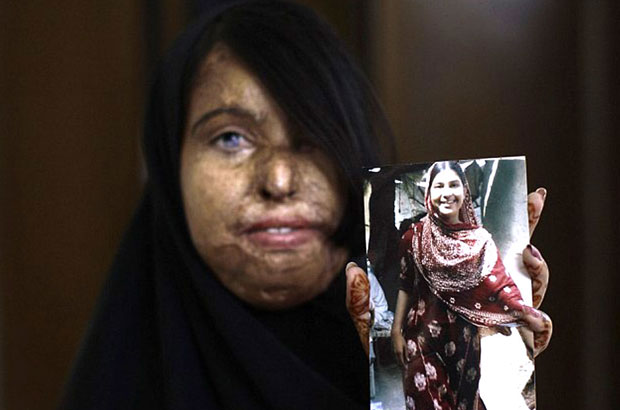 Naila, 23, shows a picture of herself before she became a victim of an acid attack. Picture: Acid Survivors Foundation